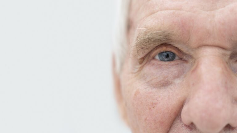 Cataract Surgery Hospital in Bangalore